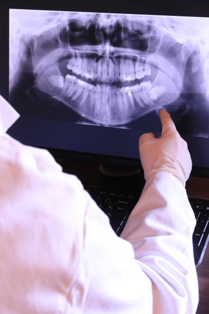 Best Emergency Dental Services for Seniors in Kentfield, CA